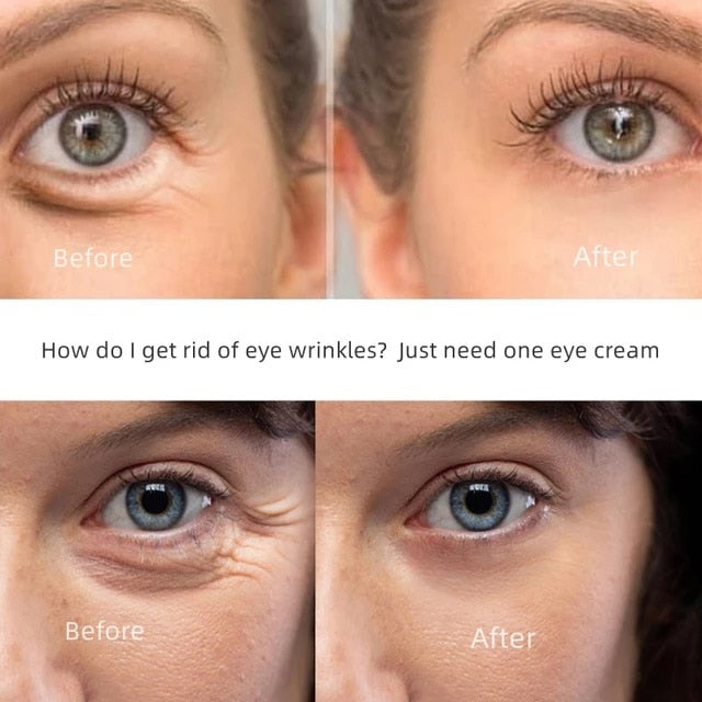 New Anti-Wrinkle Eye Cream